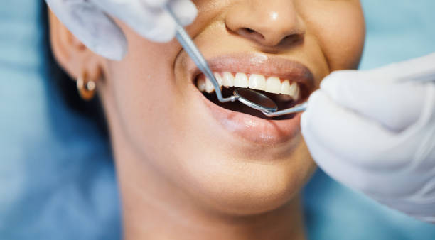 Best Emergency Wisdom Teeth Removal in Liberty, TX