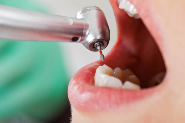 Best Emergency Orthodontic Repairs in Liberty, TX